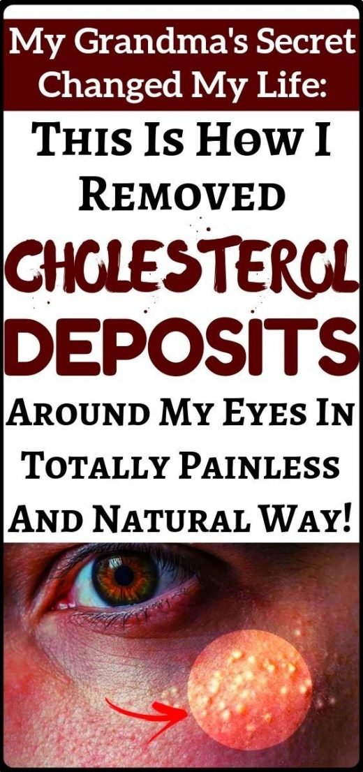 Say goodbye to cholesterol deposits around your eyes – health and fitness!