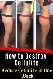 How to Get Rid of Cellulite for Good