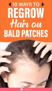 10 Ways To Regrow Hair On Bald Patches